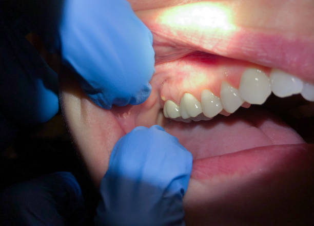 Best Walk-In Emergency Dentist in Altus, OK
