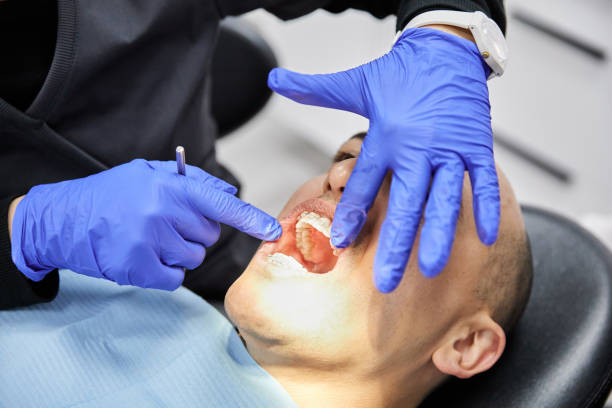 Best Emergency Root Canal Treatment in Altus, OK